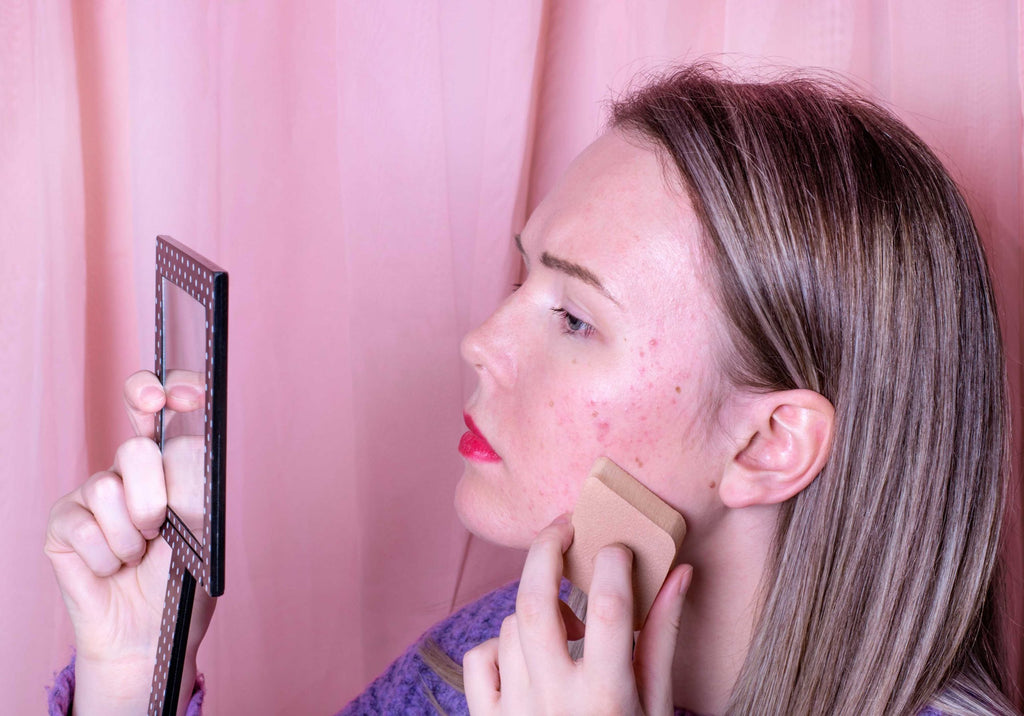 Acne Scars That Won't Go Away? Here Are Some Solutions